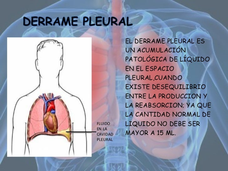Pleura & Pulmones