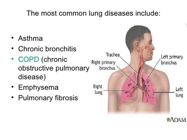 Lung disease