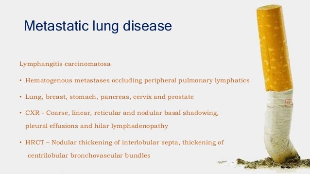 Mediastinal Pleural Plaques