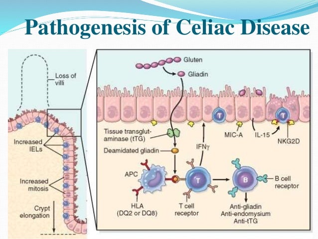 2019 year - Risk Factors for Autoimmune Disorders 2019 year