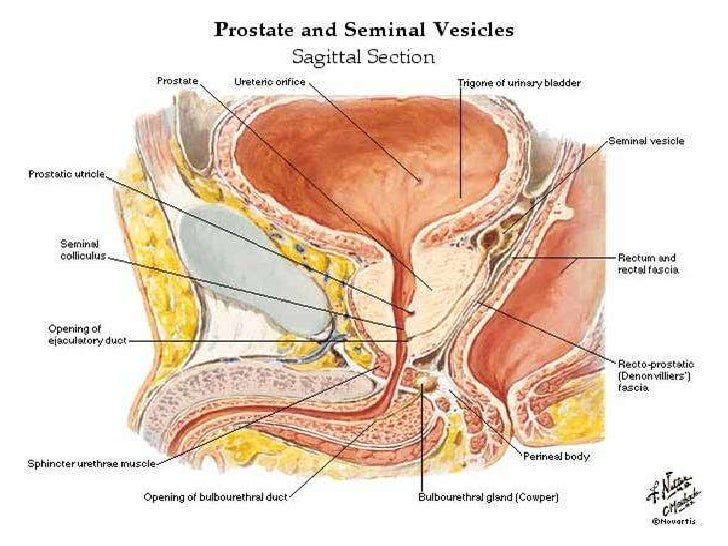 fluid in pelvis male
