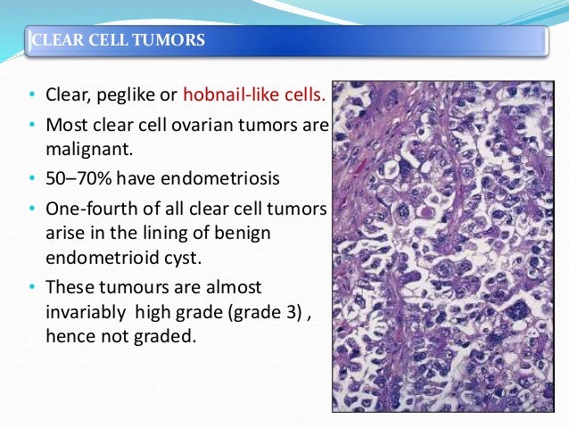 Most cancers Borderline Ovarian