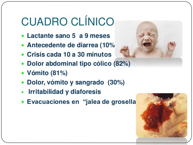 Malrotación e Invaginación intestinal.