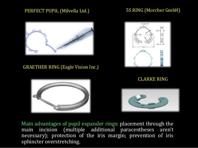 malyugin ring