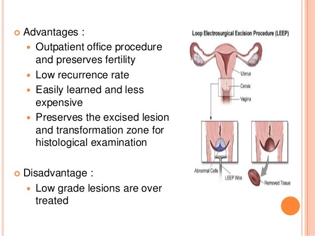 Discussion on this topic: Having Children After Cervical Cancer, having-children-after-cervical-cancer/ Communication on this topic: Having Children After Cervical Cancer, having-children-after-cervical-cancer/