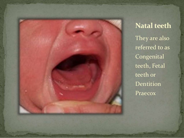 molar teeth