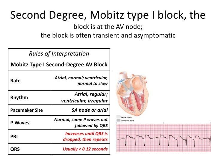 Management of peri arrest arrhythmias