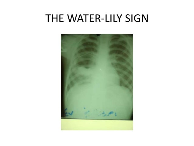 find a legal professional grim fandango