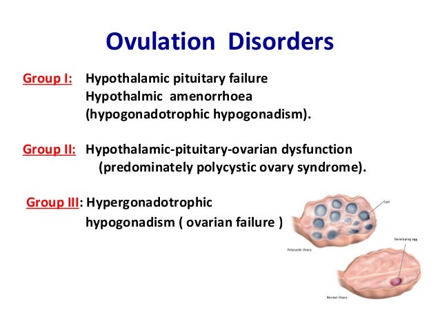 about ovulation disorders