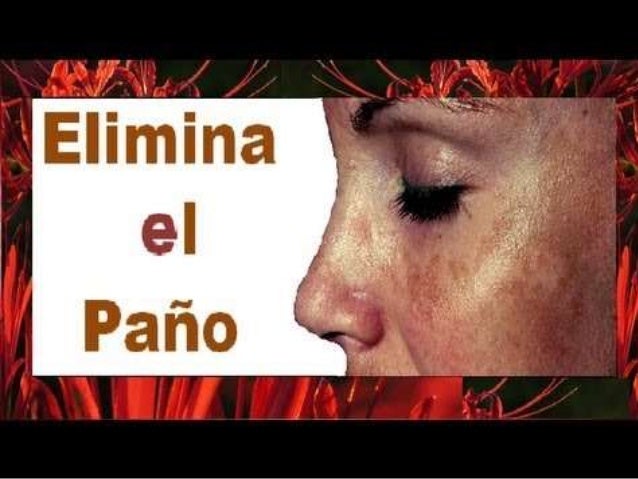 La desaparición de las manchas de pigmento por medio de la agua oxigenada