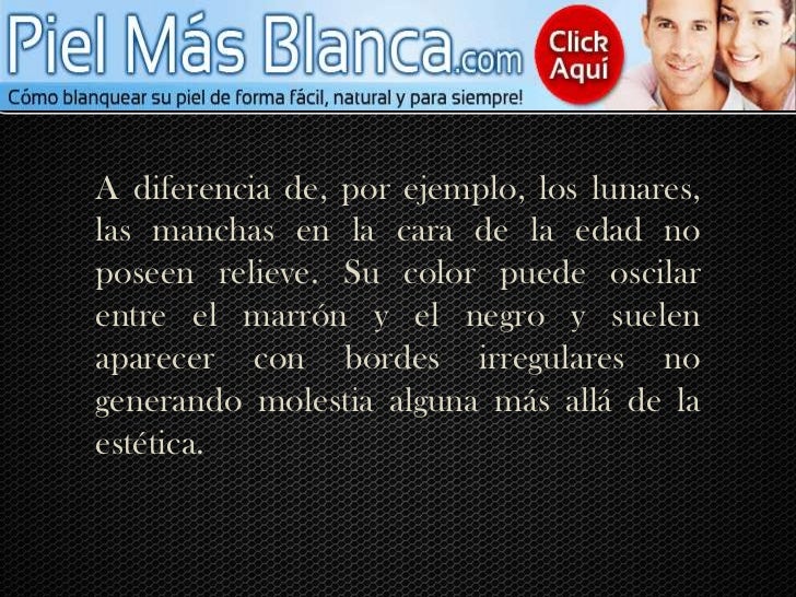 No puedo quitar las manchas de pigmento
