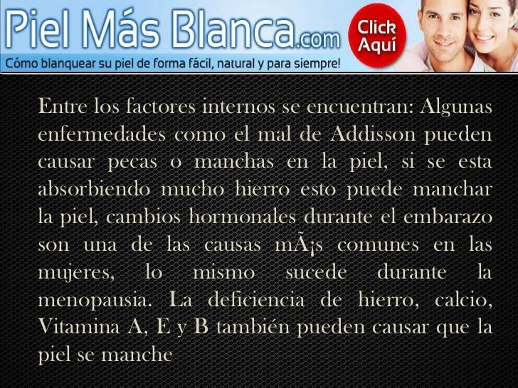 Por la ausencia connatural de la pigmentación de la piel