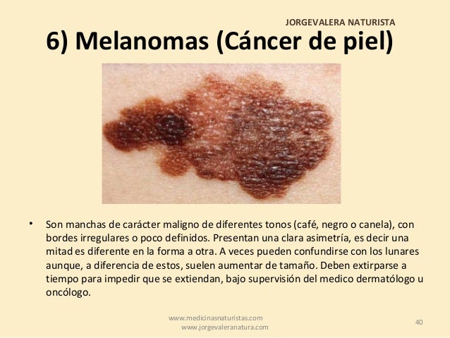 Most cancers De Piel