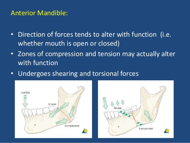 treatment of mandibular fractures by means of compression osteosynthesis Treatment ðšconservative ð§lag technique compression of fracture screw must be perpendicular to #, overdrill near cortex so that threads engage only the far cortex = compression ð§not. treatment of mandibular fractures by means of compression osteosynthesis Treatment ðšconservative ð§lag technique compression of fracture screw must be perpendicular to #, overdrill near cortex so that threads engage only the far cortex = compression ð§not.