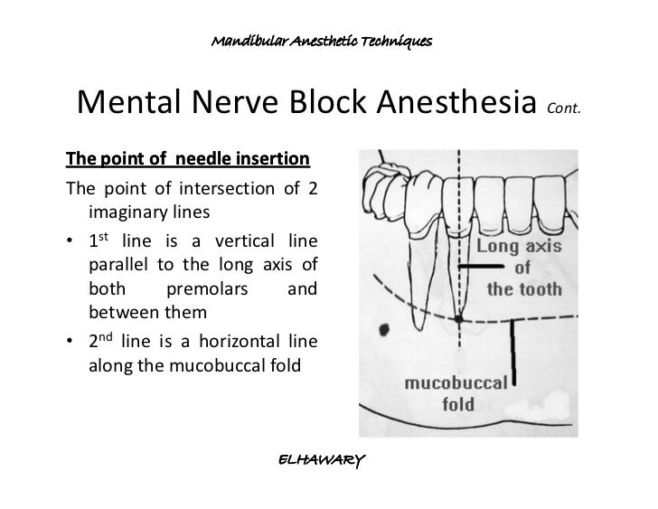 Mandibular anesthetic techniques