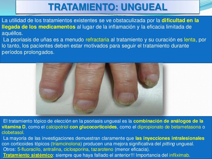 Que arreglar las manchas después de la psoriasis