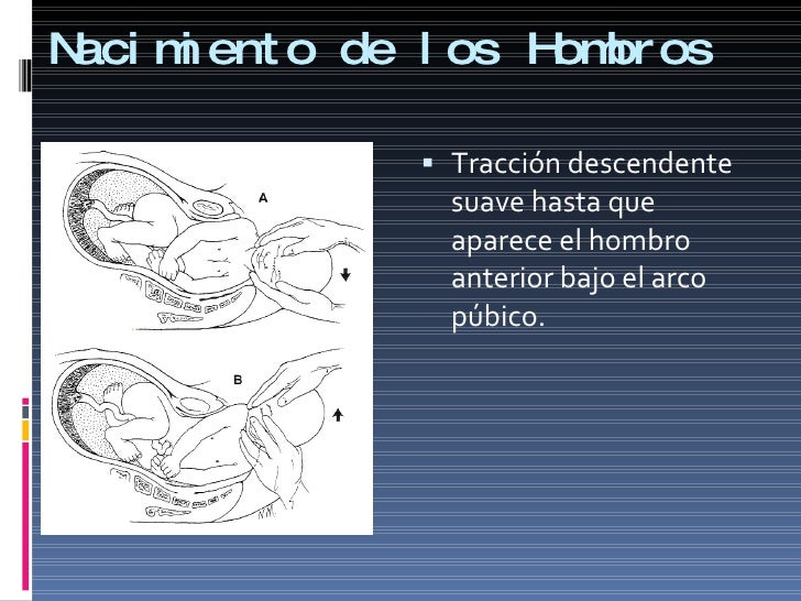 Manejo Del Parto EutóCico