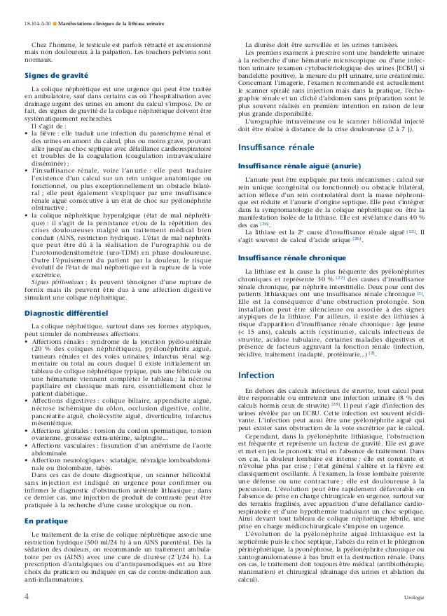 Manifestations cliniques de la lithiase urinaire Manifestations cliniques de la lithiase urinaire