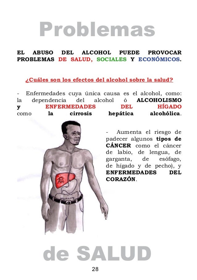 Como se llama el pinchazo para la codificación del alcohol