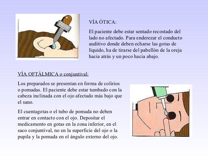 Temporal lifting las personas