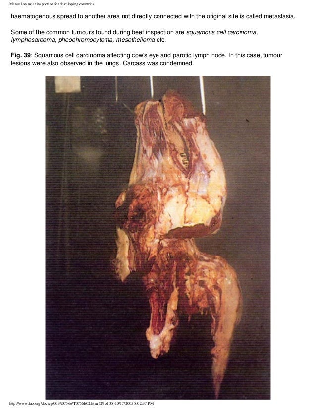 mesothelioma help scholarship