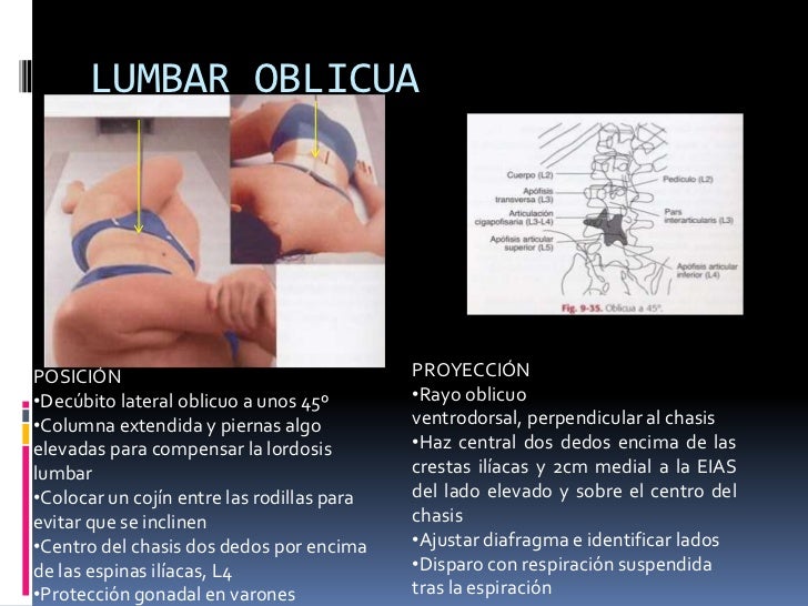 El dolor en la espalda la neurología los síntomas