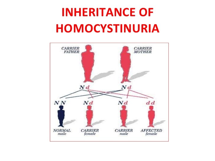 Maple syrup urine disease MSUD and Homocystinuria