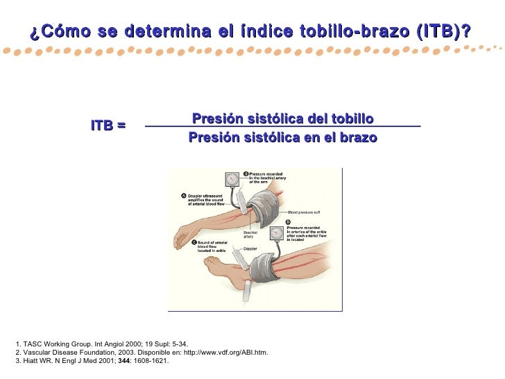 Medición índice Tobillo-Brazo
