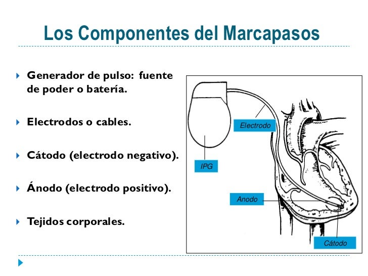 Marcapasos