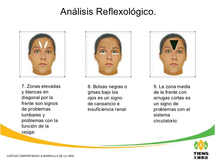 Los hinchazones bajo los ojos de por la columna vertebral