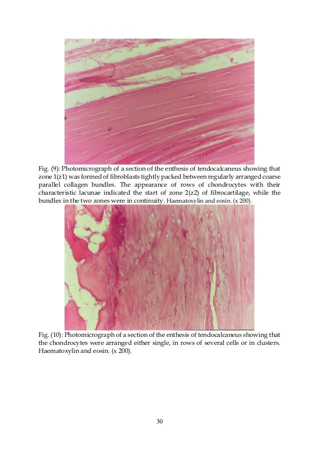 Infraspinatus enthesis