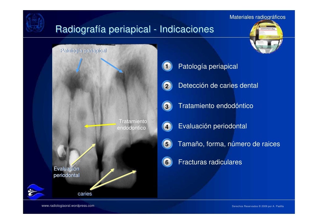 MATERIALES RADIOGRÁFICOS