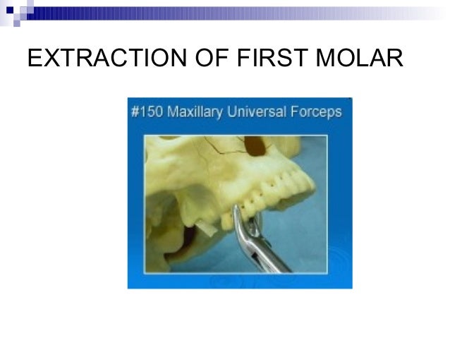 nasal polyp operation recovery