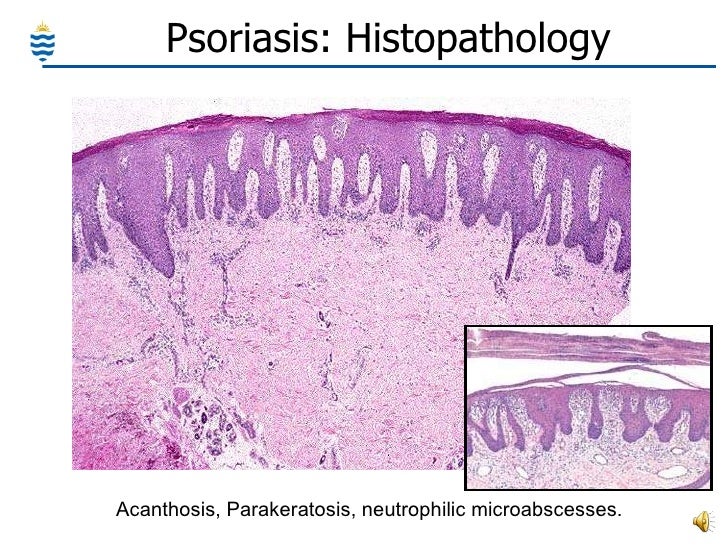 Pathology of Skin Common Disorders