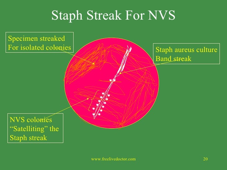 Mdl 237 Streptococci
