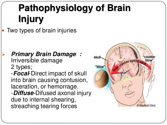 stroke reason blindness
