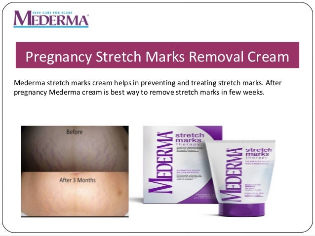 mederma cream remove stretch marks