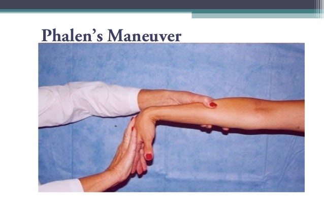 pronator syndrome pronator syndrome