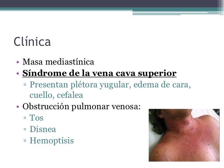 Duele los riñones del pecho los dolores esto que