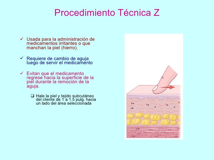 Tecnica De Z Para Inyectar Hierro es.slideshare.net