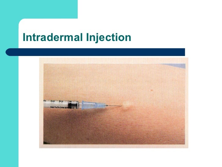 Medication administration