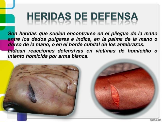 Heridas por Armas Blancas
