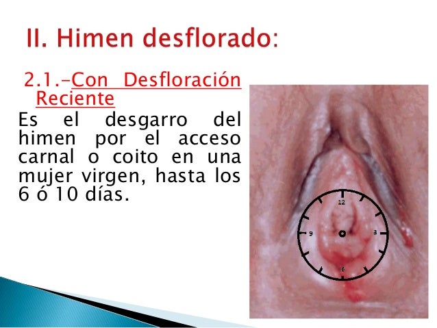 todas desfloración todas desfloración