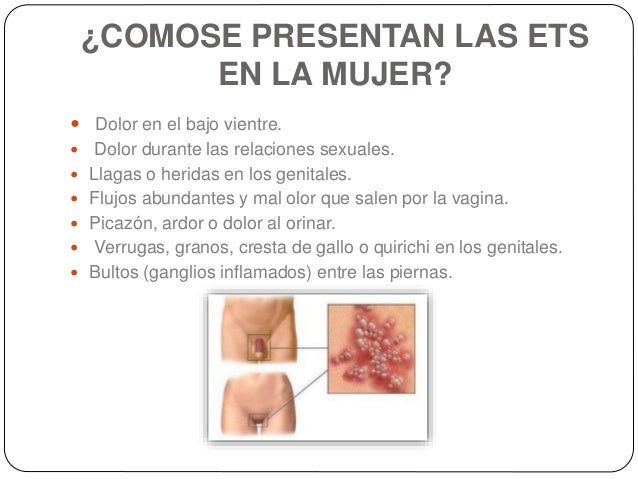 Como hacer negro la máscara para la persona de la gelatina