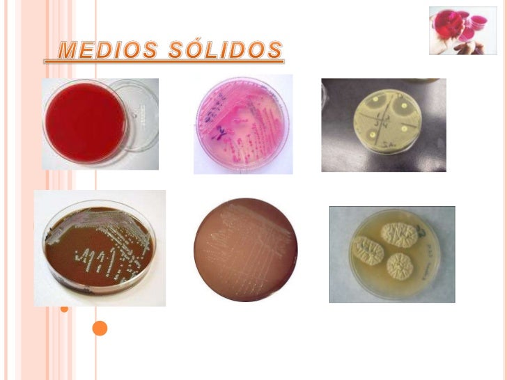 Medios de cultivo, métodos de siembra