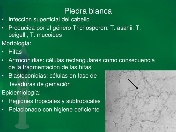 Hay algo nuevo en el tratamiento del hongo de uña