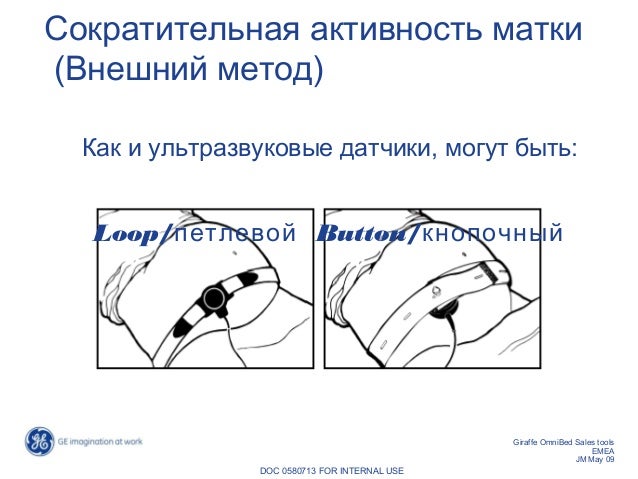 Вес плодов при двойни Вес плодов при двойни