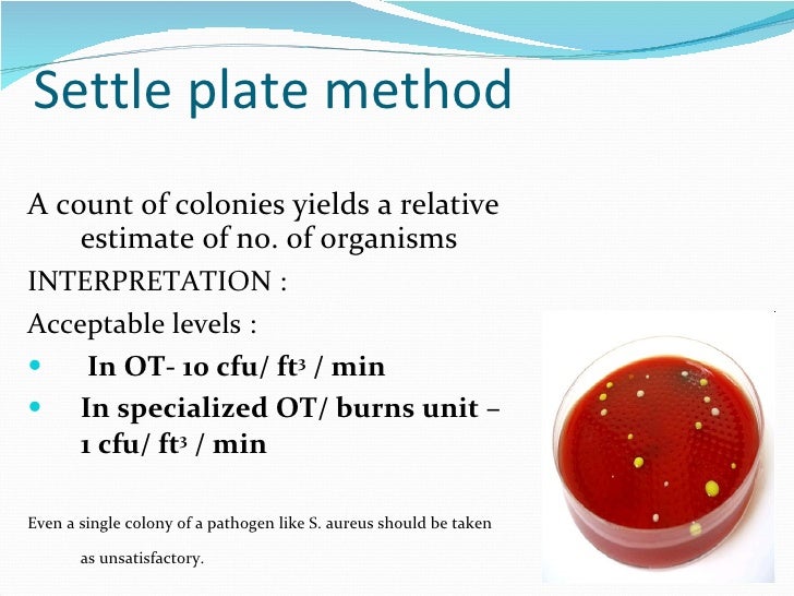 M icrobiological surveillance of ots