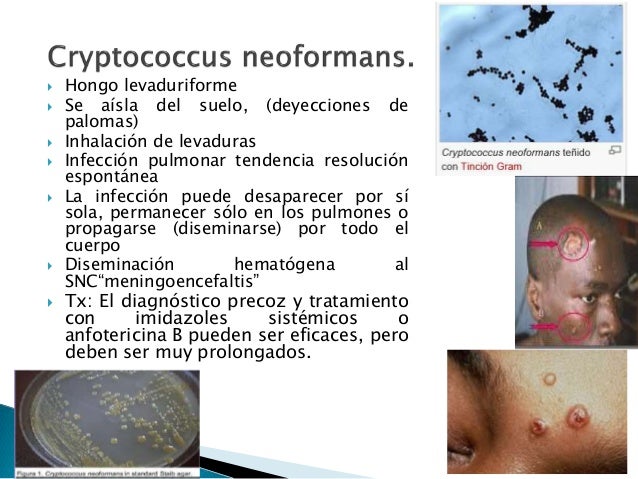 Las sustancias desinfectantes al hongo de las uñas