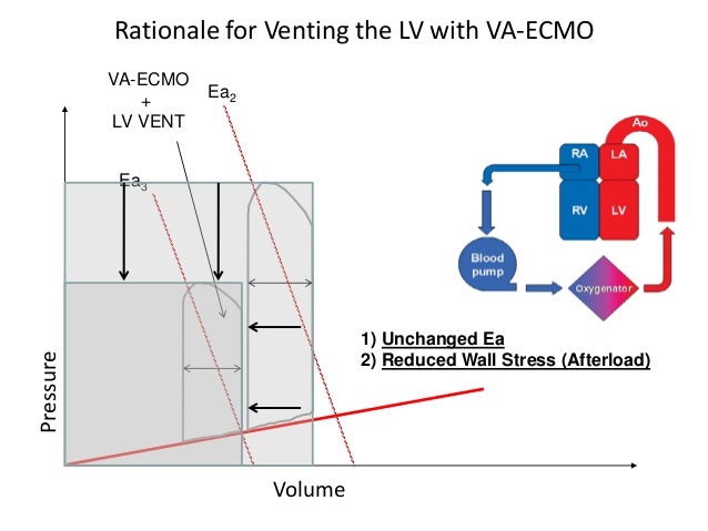 Understanding the Translational Value of PV Loops from Mouse to Man